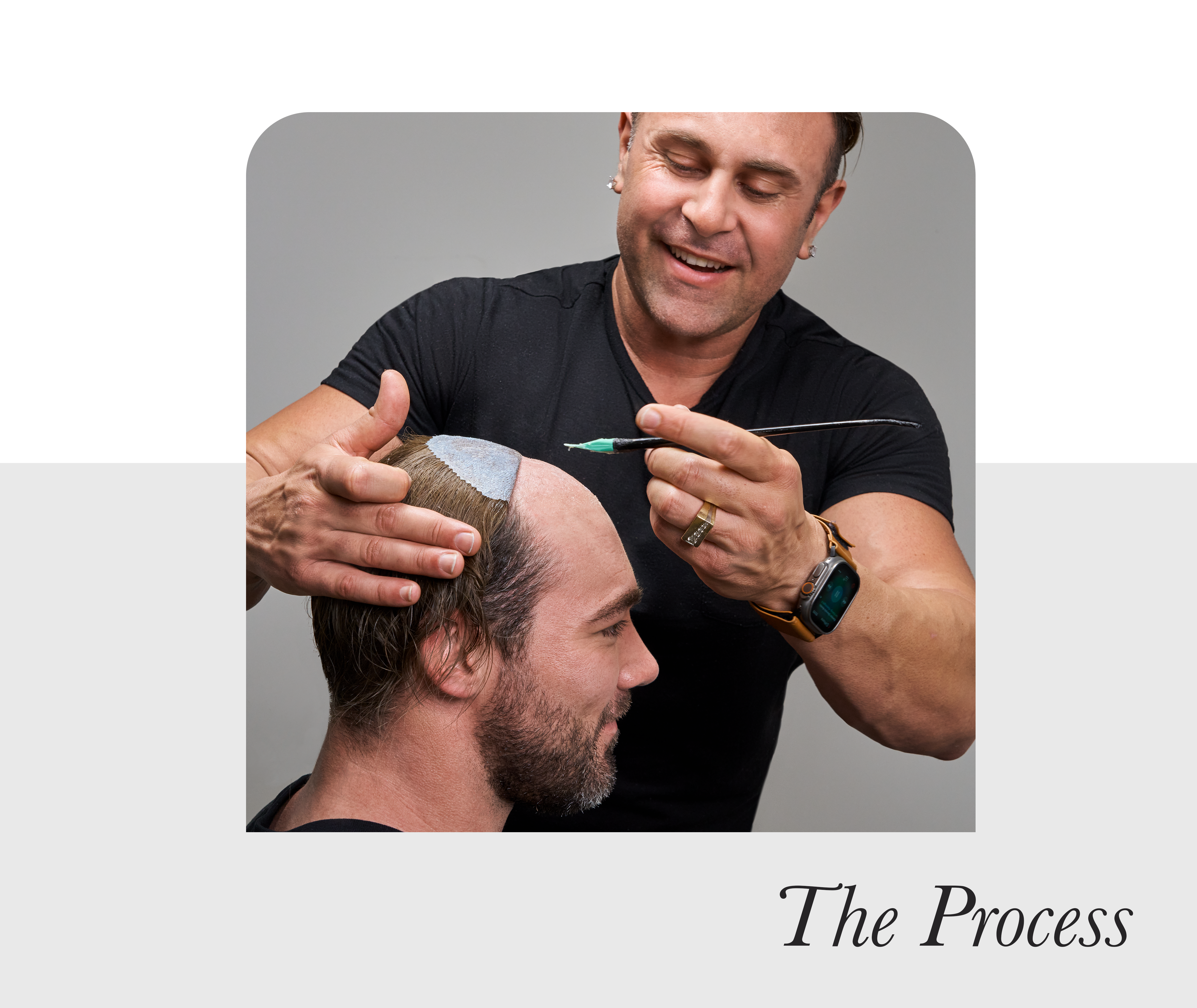 The hair replacement process