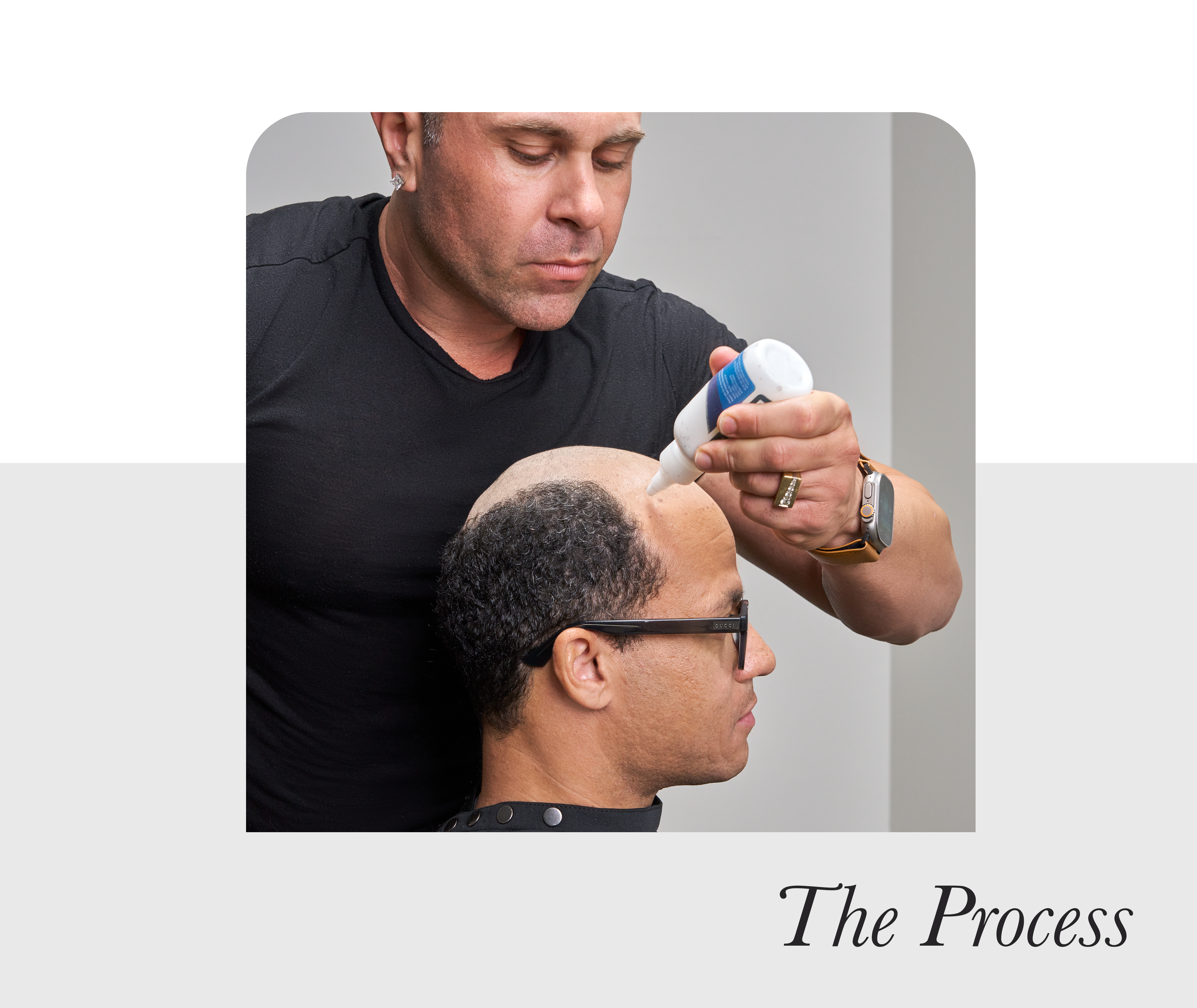The hair replacement process with the Jon Renau Noah system